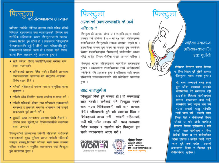 Fistula brochure
